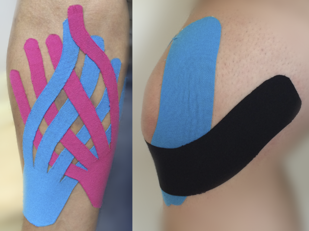 KinesioTaping vendaje