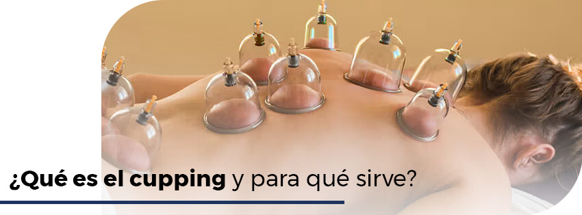 que es el cupping y para que sirve